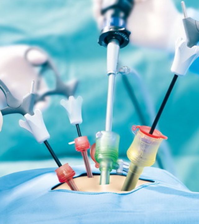 Advanced Laparoscopic Surgeries