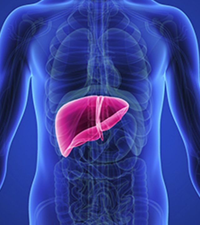 Liver Transplantation