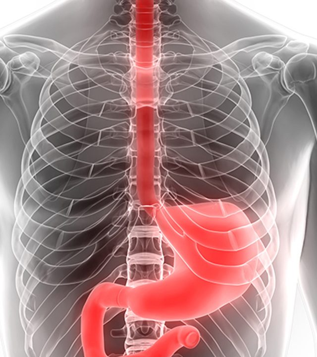 Upper GI Surgeries