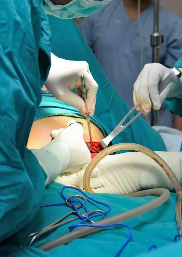 Abdominal Trauma Surgery