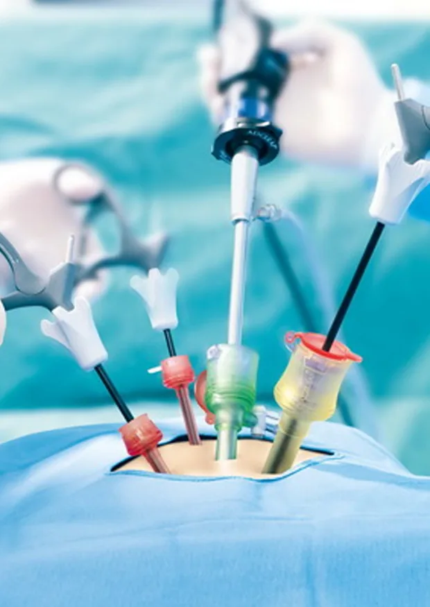 Advanced Laparoscopic Surgeries