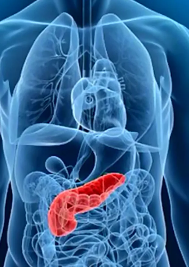 Pancreatic Surgeries