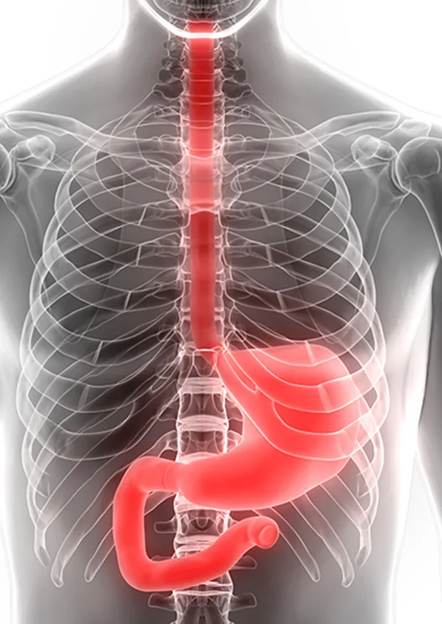 Upper GI Surgeries