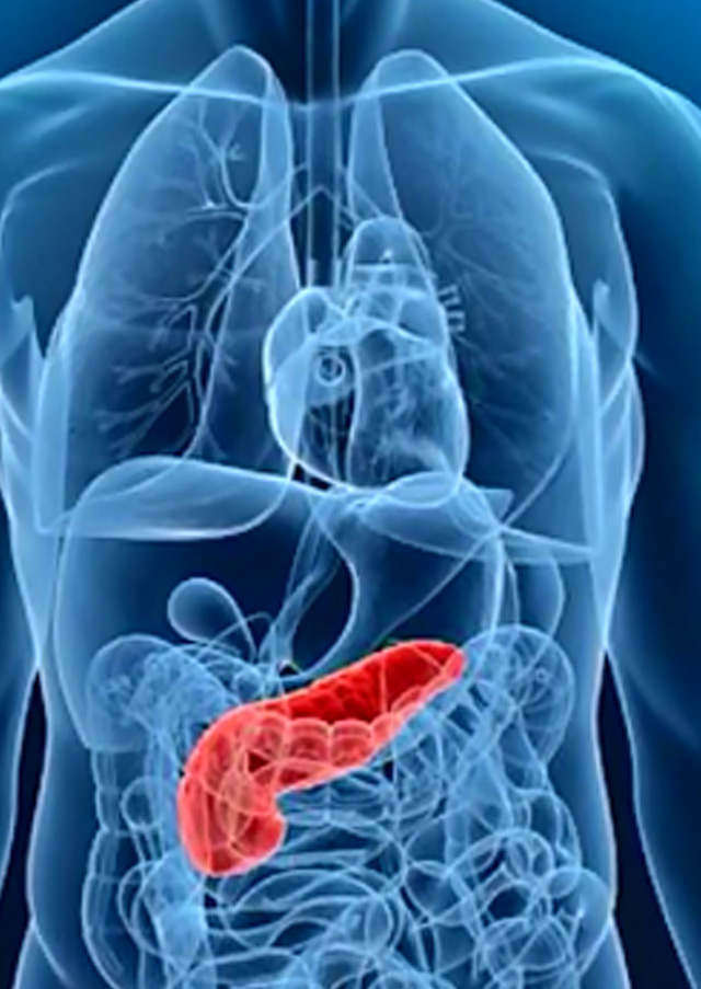 Pancreatic Surgeries